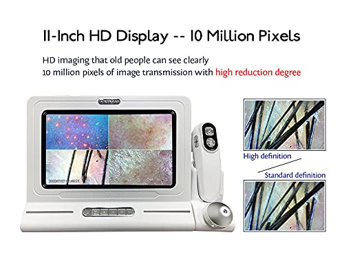 Skin Hair Scalp Detector Hair Follicle Facial Skin Oil Moisture 11 Inch HD LCD Screen Microscope Tester