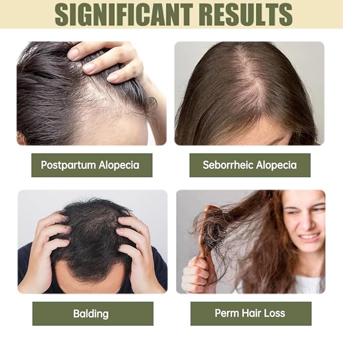 Hair Growth System, With Ginseng, Peppermint Oil and Ginger Root Treatment-Advanced Scalp Care Formula Thickening Serum. Strengthens Roots, For Men & Women.