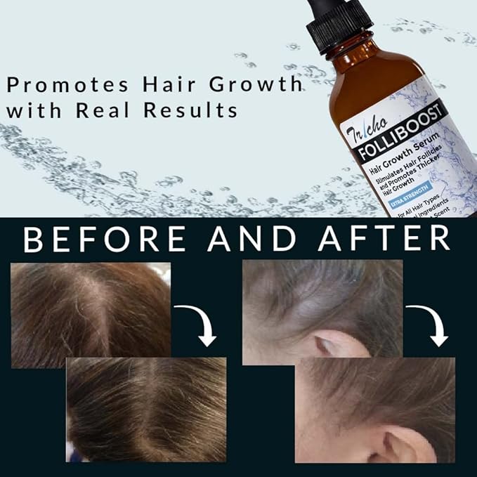 Tricho Labs Folliboost Hair Growth Serum - Natural-Based Formula w/Biotin & Peppermint Oil - Hair Care for Thicker & Fuller Hair - 2oz, 6-Pack