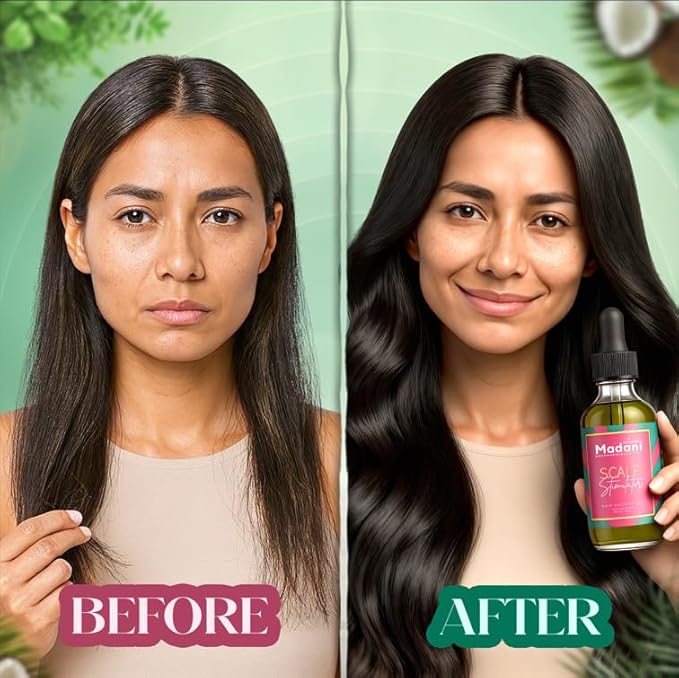 Madani Naturals Scalp Stimulator Hair Growth Oil With Rosemary Oil & Mint - Hair Loss Treatment for Split End and Dry Scalp for All Hair Types, Strengthen Hair and Stop Hair Loss, 2-Fluid Ounces