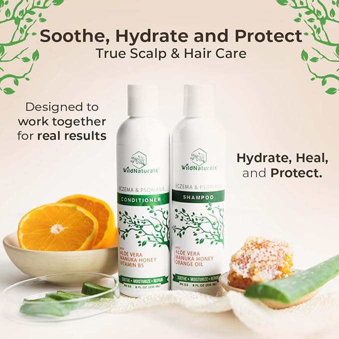 Eczema and Psoriasis Deep Conditioning Treatment - Anti-Dandruff Conditioner for Damaged, Dry Hair and Scalp - Seborrheic Dermatitis Relief