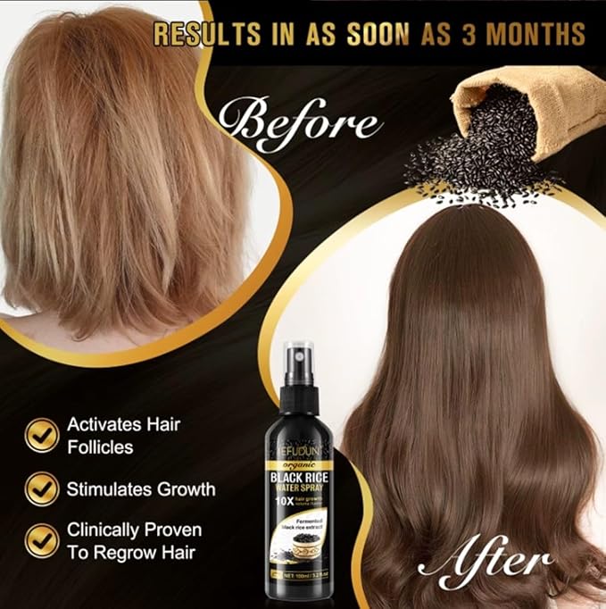 Organic Black Rice Water Spray for Hair Growth, with Castor Oil & Ginger Root Extract for Thicker, Fuller Hair, Helps in Hair Loss and helps Repair Damage 100ml/3.2 fl. Oz (1 PC) - ActivePur