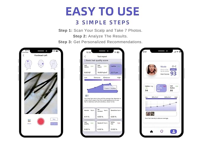 lushair Wireless Hair Analyzer, Hair Follicle Tester, Scalp Microscope, 16 Hair Tests, AI Smart Analysis Provides Care Plan
