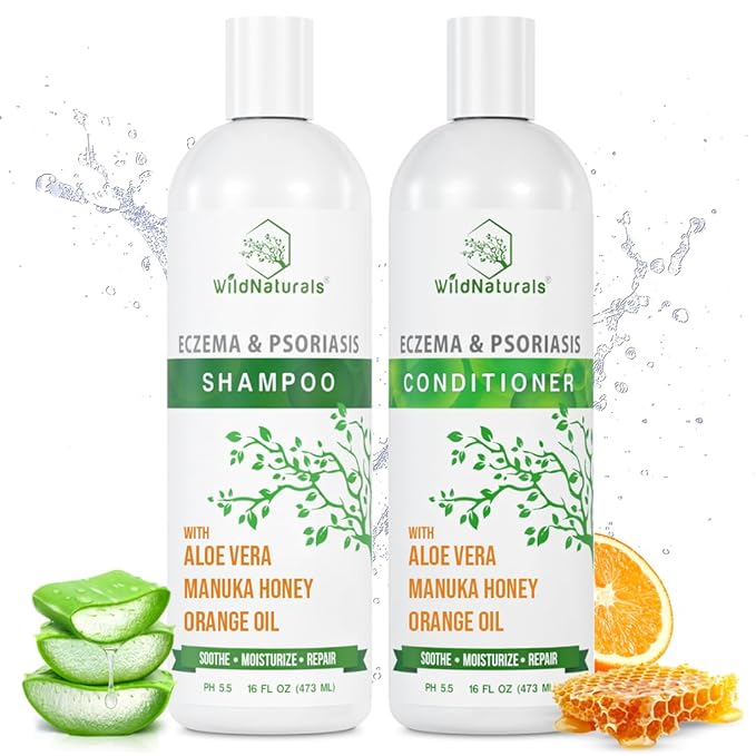 Anti-Dandruff & Seborrheic Dermatitis Treatment Shampoo & Conditioner Set for Men & Women - For Itchy, Dry Scalp and Hair with Psoriasis & Eczema