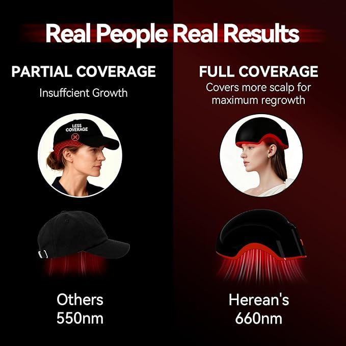 Red Light Therapy for Hair Growth, Laser Cap Red Light Higher Dose for Hair Regrowth FDA Cleared for Hair Loss Treatment LLLT Hair Thinning & Alopecia for Men Women