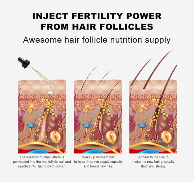 Vedora Ginger Oil for Hair Growth alongwith Roller - Hair Growth Serum, 100% Pure Natural Ginger Essential Oil - Promotes Strong, Thick, Long Hair in Women & Men - 5.05 Fl Oz / 150ML (5 PCS+Roller)