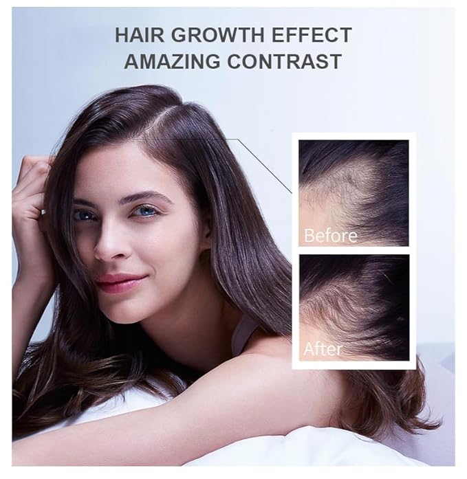 Vedora Ginger Oil for Hair Growth - Biotin Hair Growth Serum, 100% Pure Natural Ginger Essential Oil - Promotes Stronger, Thicker, Longer Hair in Women & Men - 2.0 Fl Oz / 60ML (2 PCS)