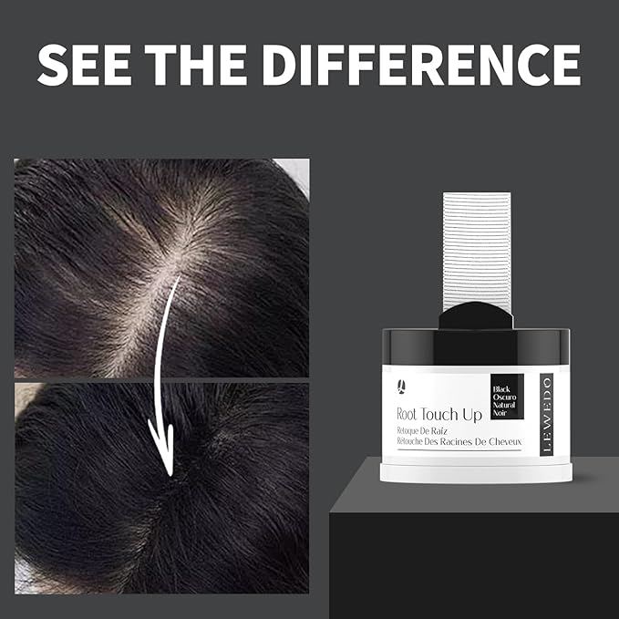 Hairline Powder 24H Stain-Proof, Root Touch Up Hair Color for Gray Coverage,Bald Spot Concealing Hair Shadow Powder for Women & Men,Natural-Looking (Light Blonde)