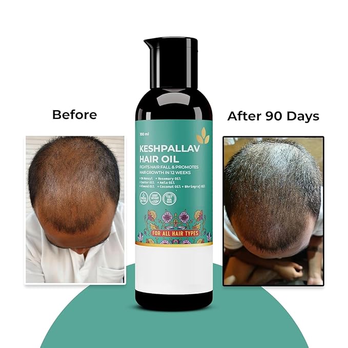 Keshpallav Hair Oil For Men & Women | Promotes Hair Growth & Reduces Hair Fall | With Rosemary, Castor, Amla, Coconut and Bhringraj Oil | Mineral Oil Free | 100 ml