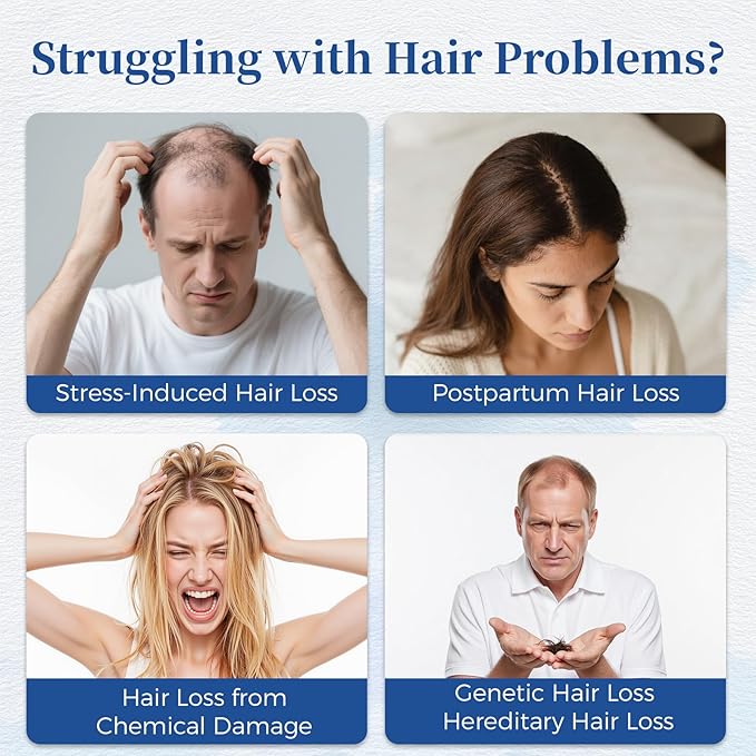 Hair Growth Serum Roll On with Rosemary，Helps Support Thicker, Fuller Hair Appearance，Clean, Non-Greasy Hair Loss Support for Men & Women，Saw Palmetto，0.84 Fl Oz (Pack of 1)