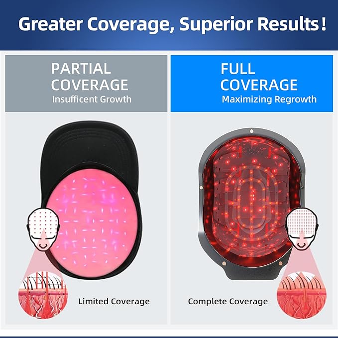 Laser Red Light Therapy for Hair Growth Device, FDA Cleared Hair Loss, Hair Growth Device