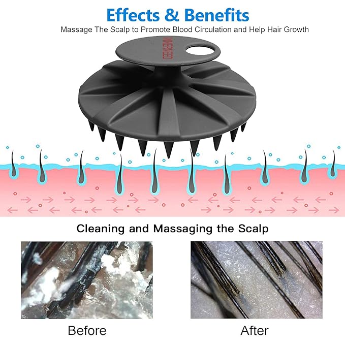 INNERNEED Scalp Care Massager Shampoo Brush, Wet & Dry Manual Head Scrubber Hair Washing, Soft Silicone Bristles, for Hair Growth, Dandruff Removal, Comfortable for All Hair Types (Black)