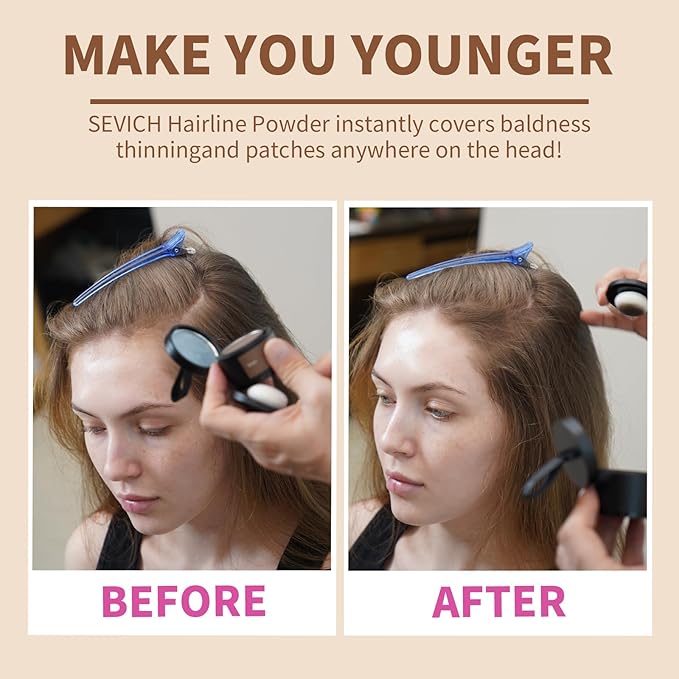 Sevich Hairline Powder,Instantly Conceals Hair Loss, Root Touch up Powder, Hair Shadow Toppers for Women & Men, Touch Up for Thinning Gray Hair, Windproof & Sweatproof,Medium brown