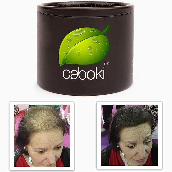 Hair Loss Concealer. Cover Bald Spot and Thinning Hair Instantly. Make Thin Hair Look 10X Fuller. All-Natural Hair Building Fiber. Trial Size (10-Day Supply). Dark Brown
