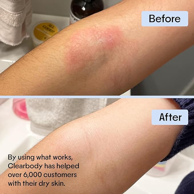 Clearbody Organics Manuka Honey Cream - 2 Fl Oz - Soothing Eczema Cream - Deep Hydration with Colloidal Oatmeal - Instant Manuka Relief for Dry, Itchy Skin