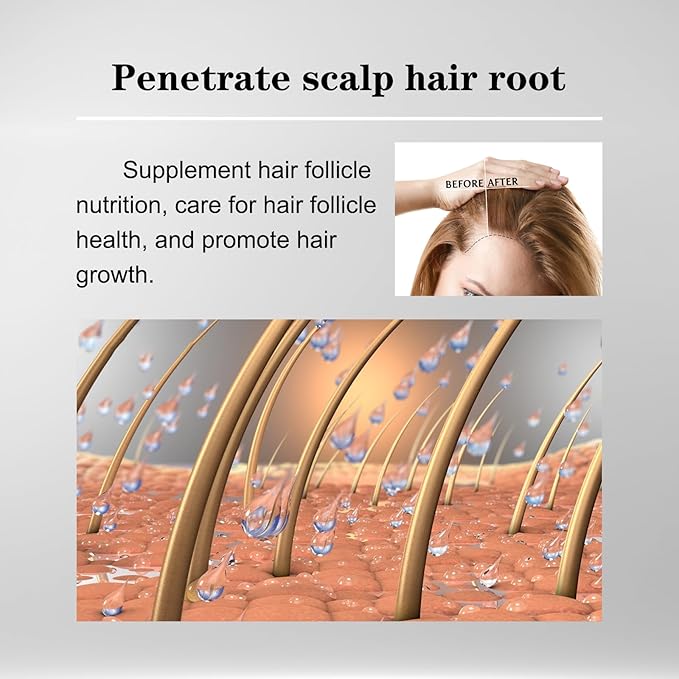 5% Minoxidil Hair Liquid for Men & Women, 2 x 3ml, with Ginseng & Ginger Root Extract - Hair Growth Supporting Treatment for Thinning Hair, Scalp Care Serum to Help Reduce Hair Loss Appearance