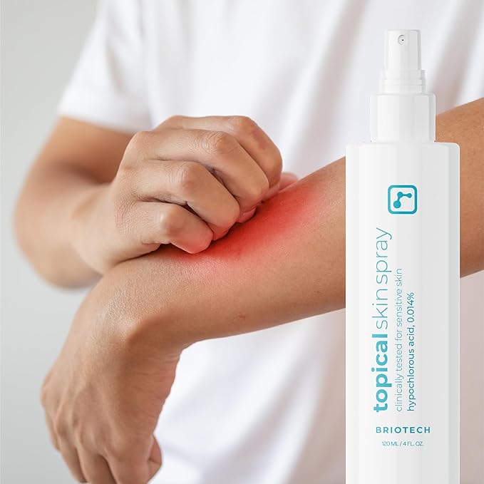 BRIOTECH Topical Skin Spray, Hypochlorous Acid Spray for Sensitive Skin, HOCl Facial Mist, Full Body Support Against Irritation, Calm Redness, Soothe Foot & Scalp, 4 oz