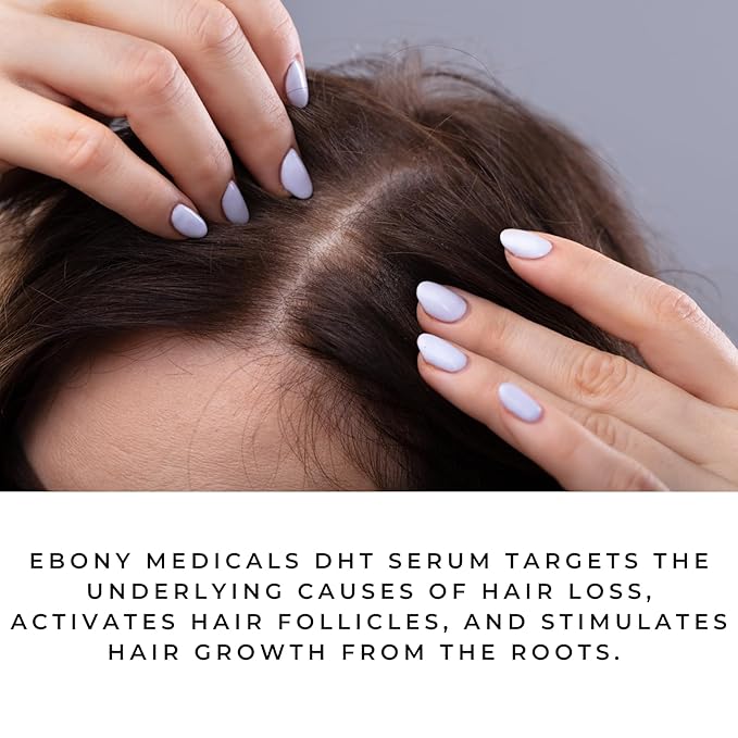 Ebony Medical DHT Blocker Hair Growth Serum for Thinning Hair – Hair Regrowth Treatment for Men & Women – Procapil Formula – Thickens Fine Hair – Liposomal Scalp Serum – 2 fl oz