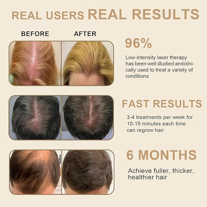 Laser Hair Growth Comb