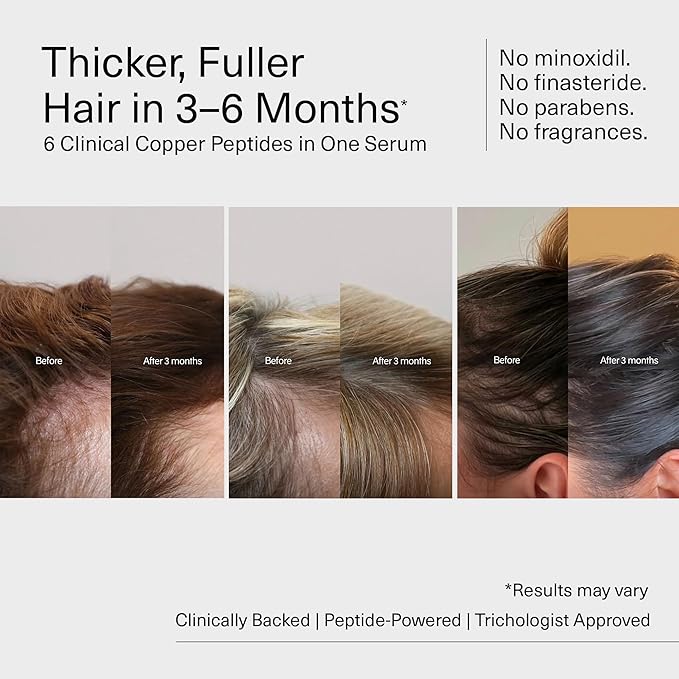 Bloom Clinically Proven Copper Peptide Hair Serum for Hair Growth - Non-Greasy & Lightweight Advanced Multi-Peptides for Women w/Thinning Hair - Promotes Fullness, Reduces Shedding - Made in USA