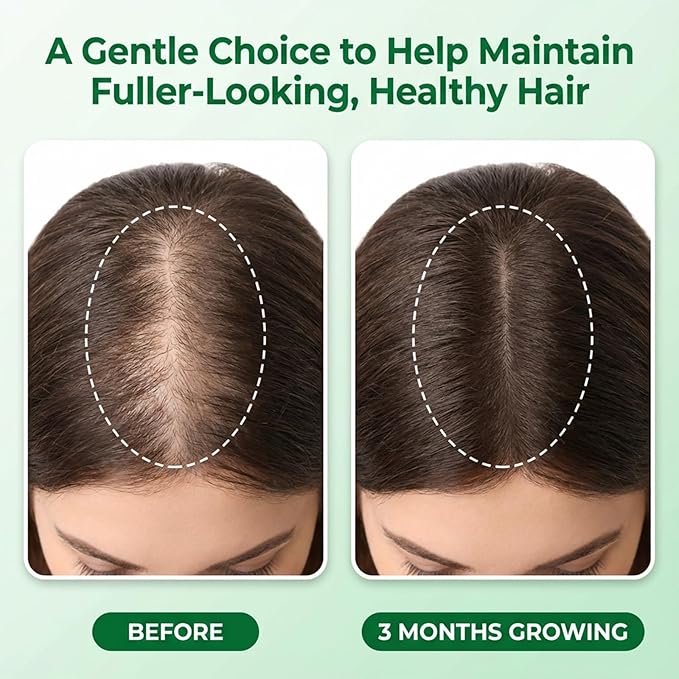 Hair Growth Care Serum Roll-On with Rosemary, Niacinamide, Amino Acids, Ginger, Biotin, Castor Oil, Batana & Caffeine, Nourishes Scalp for Thicker-Looking, Healthy Hair, 30ml/1.01 fl.oz