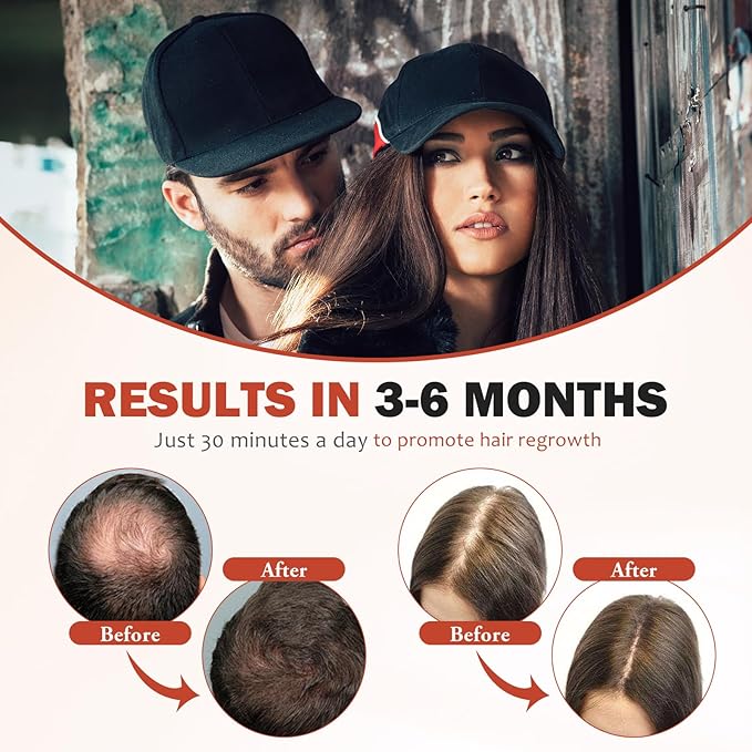 LLLT Laser Hair Growth Cap, Rechargeable Portable Laser Hair Growth Cap to Promote Hair Growth, Black