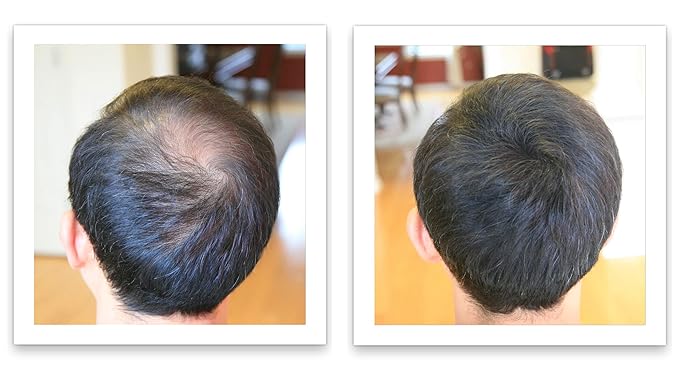 Caboki Hair Volumizer: Root Touch Up, Fill in Hairline & Edges, Cover Thinning, Bald Spots, and Gray Hair - Talc-Free, Healthful Powder for Men and Women. Blonde
