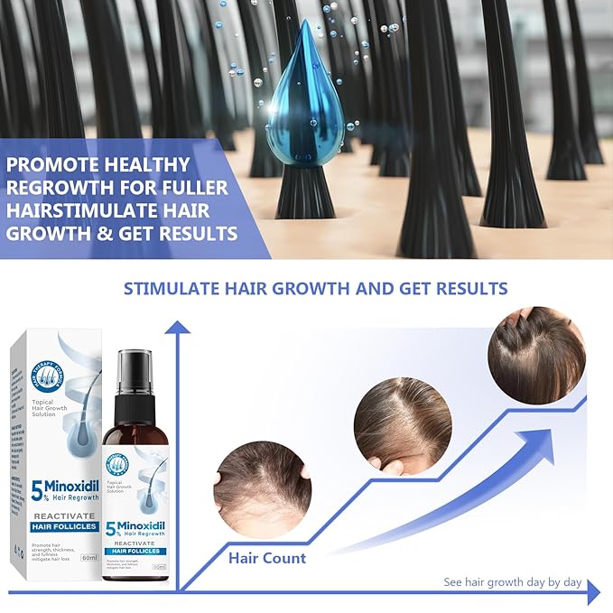 Minoxidil for Men, 5% Hair Growth Serum for Men And Women Combat Hair Loss and Thinning, Supports Thicker and Fuller Hair & Beard, 60ml