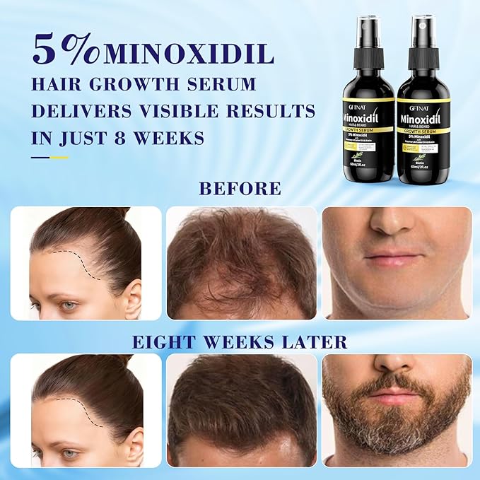 5% Minoxidil for Women with Biotin Hair Growth Serum, Minoxidil for Men Spray with Rosemary for Thicker Fuller Hair
