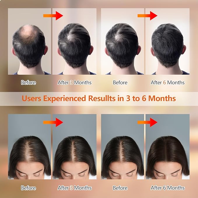 Laser Cap for Hair Growth, Red Light Therapy for Hair Growth, with Timer & Controller, Strengthening Hair Roots, Hair Thinning & Alopecia Treatment for Men & Women (Brown)