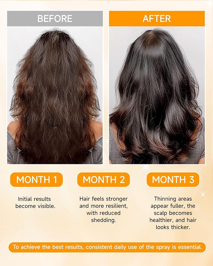 Hair Growth Spray, Hair Growth Oil Spray, with Biota Orientalis, Rosemary Oil & Biotin, Strengthens Hair Roots, Prevent Hair Thinning & Loss, Thicker Fuller Hair for Women & Men (1 pack, 3% Rosemary)