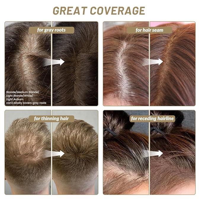 SOVONCARE Instantly Hairline Powder, Hairline Shadow Gray Hair Coverage Touch Up Hair Powder for Thinning Hair for Women Hair Root Touch Up Powder Hair Root Cover Up Conceals Hair Loss Dark Brown