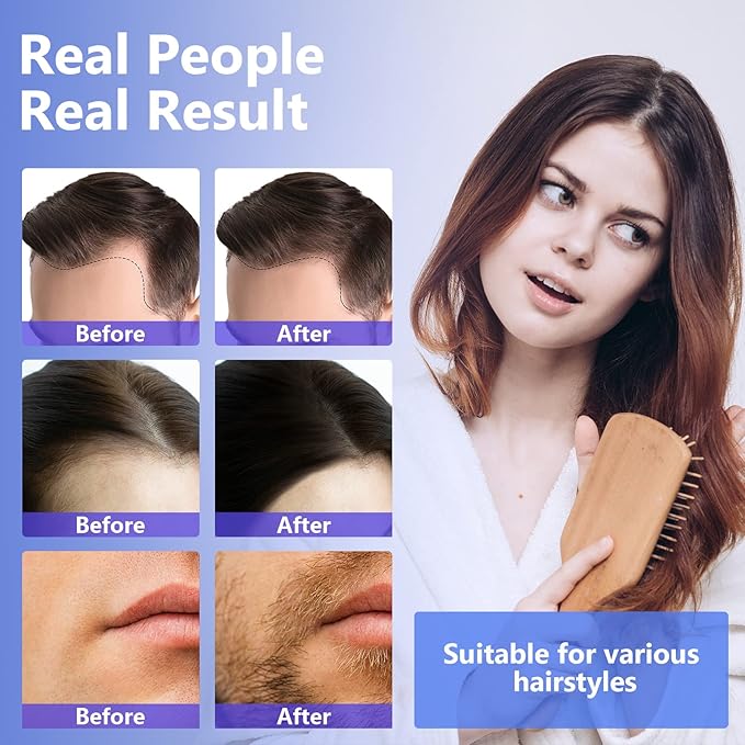Minoxidil for Men, 5% Hair Growth Serum for Men And Women Combat Hair Loss and Thinning, Supports Thicker and Fuller Hair & Beard, 60ml