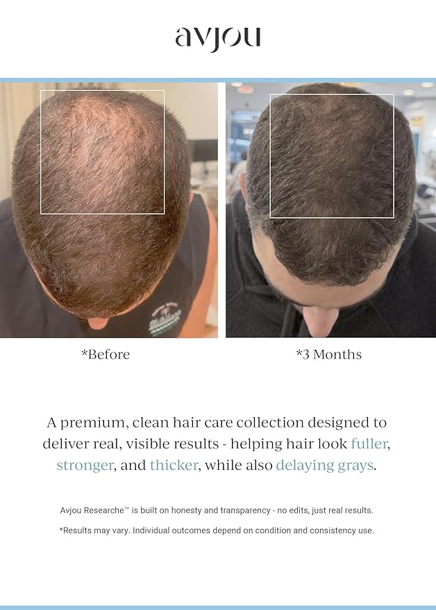 Avjou Researche™ Scalp Serum – Thicker, Fuller-Looking Hair + Targets Visible Signs of Premature Greying – 3 Patented Ingredients – Backed by Cosmetic Science – Oil-Free, All Hair Types, 1.7 oz