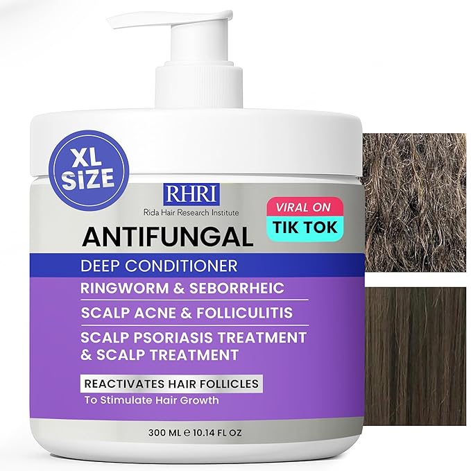 Anti Fungal Deep Conditioner for Men and Women | Scalp Treatment for Psoriasis, Dandruff, Seborrheic Dermatitis | Provides Relief from Folliculitis, Eczema, Itchy, Flaky and Dry Scalp