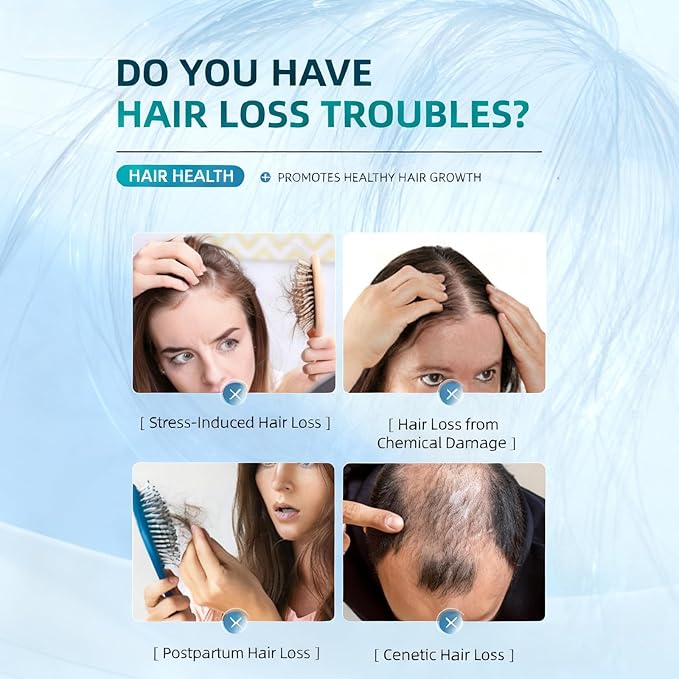 Advanced hair regeneration, rosemary hair growth essence, hair growth essence ball, improve hair density, reduce hair loss, no washing and no greasy