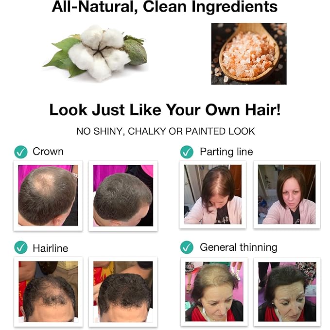 Thinning Hair Solution - All-Natural, Plant-Based Fibers For Fuller, Thicker Appearance. Instantly Covers Bald Spots. Auburn (red/ginger hair). Trial Size, 10-Day Supply