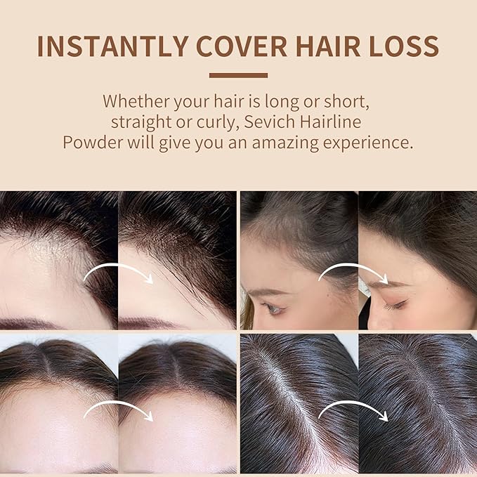 Sevich Hairline Powder,Instantly Conceals Hair Loss, Root Touch up Powder, Hair Shadow Toppers for Women & Men, Touch Up for Thinning Gray Hair, Windproof & Sweatproof,Medium brown