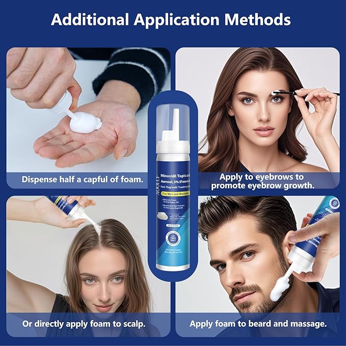 5% Topical Minoxidil Foam, Minoxidil for Men and Women, Infused with Biotin, Hair Growth Treatment, Supports Thicker and Fuller Hair & Beard (Minoxidil Foam, 6.33oz, 3 Month Supply)
