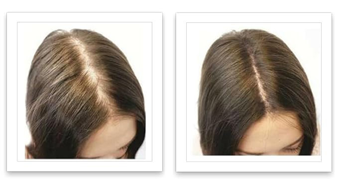 Caboki Healthful Powder Volumizer for Men & Women: Thinning Hair Solution for Root Touch Up, Hairline & Edges, Covering Hair Loss, Bald Spots & Gray Hair - TALC-Free,