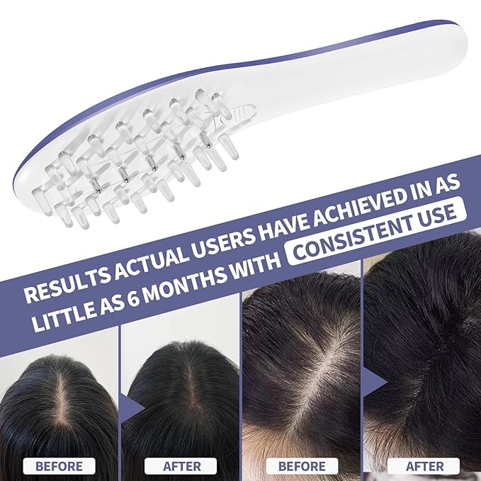 Laser Therapy Hair Growth Comb Model:Lasercomb-001, Hand-held Comb-Shaped Low Level Laser Therapy Device That emits Laser Light Designed to Promote Hair Growth in Women and Men.