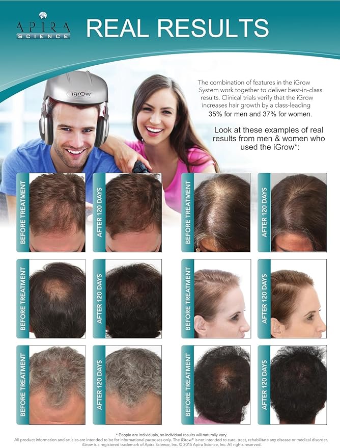 iGrow Laser Hair Growth System - Red Light Therapy, Clinically Proven, FDA Cleared Laser Cap Hair Growth for Men & Women
