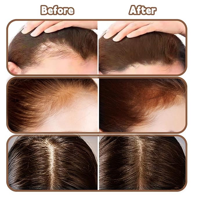 Root Touch Up Powder Hair Color Medium Brown, Root Cover Up Hair Powder for Women Scalp Concealer, HairlinePowder for Women GrayHair