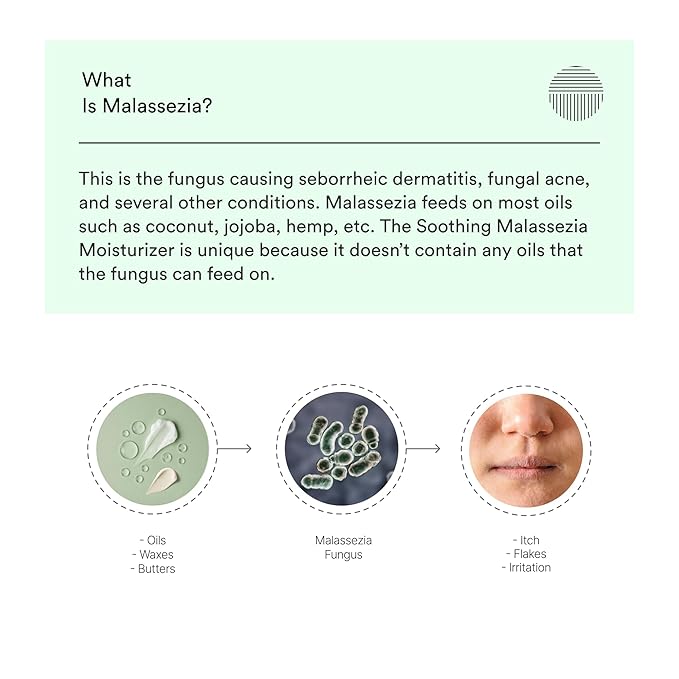 Malassezia Moisturizer, Soothe and Relieve, Safe for Folliculitis and Seborrheic Dermatitis, 2 fl oz