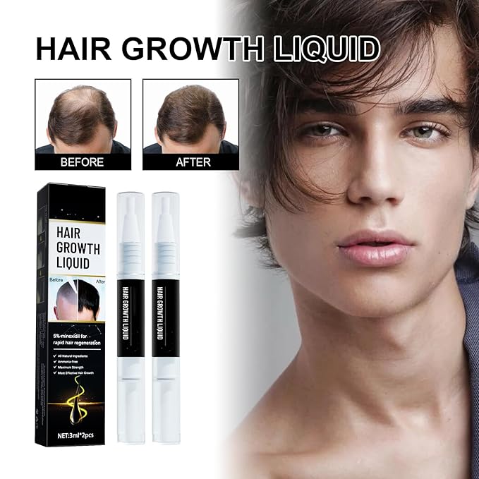 5% Minoxidil Hair Liquid for Men & Women, 2 x 3ml, with Ginseng & Ginger Root Extract - Hair Growth Supporting Treatment for Thinning Hair, Scalp Care Serum to Help Reduce Hair Loss Appearance