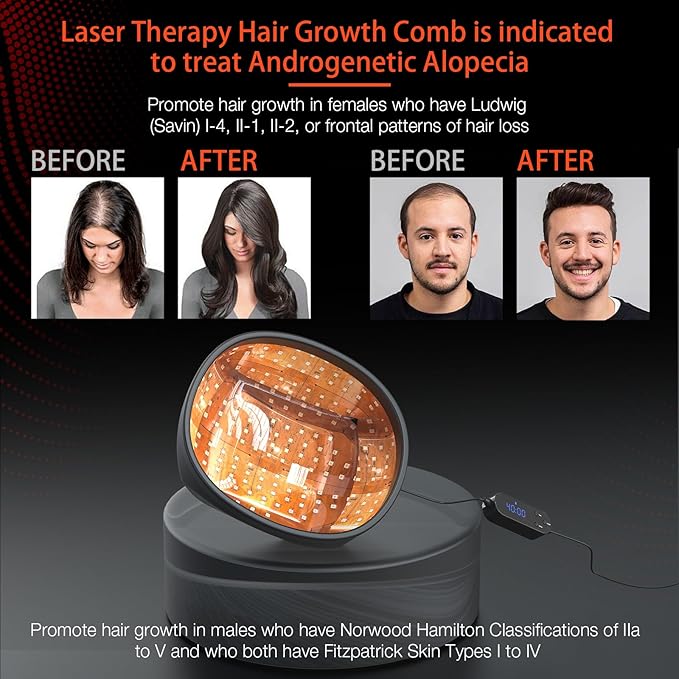 Laser Cap (FDA Cleared), Professional Medical Grade Laser Hair Growth Treatment Product for Men & Women, Red Light Therapy for Hair Growth, Treat Alopecia