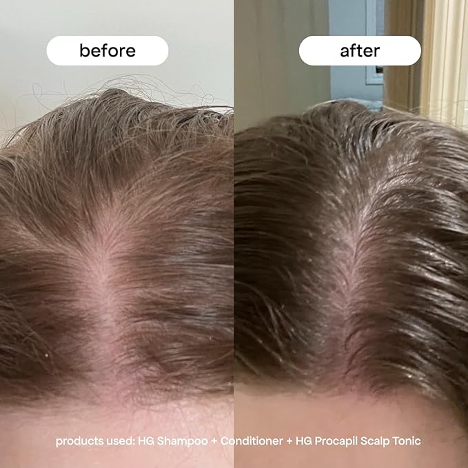 BONDIBOOST Procapil Scalp Treatment [4.23 fl oz], Daily Leave In Treatment for Thinning Hair + Anchor Hair, Scalp Serum for Thicker Hair with Procapil, Rosemary & Biotinoyl Tripeptide-1, Sulfate-Free