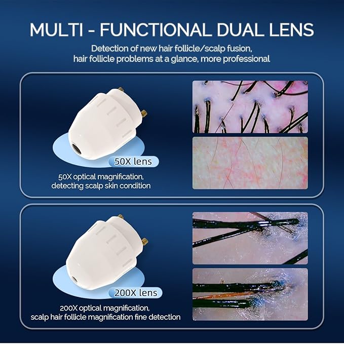 11 Inch HD Screen Scalp Analysis Machine with 50x/200x Lenses, Hair Scalp Analyzer & Microscope for Skin and Hair Follicle, No App Required, for Home & Salon Use