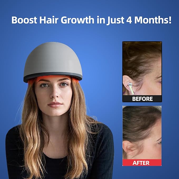 Laser Red Light Therapy for Hair Growth Device, FDA Cleared Hair Loss, Hair Growth Device