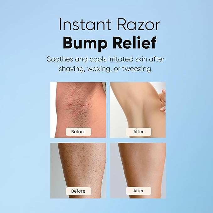 ESTETIST Razor Bump Solution Roll-On, Ingrown Hair & Razor Burn Care Serum, After Shave Roller for Bikini Area, Face, Neck, Underarm & Legs, Skin-Soothing Post Shave Care